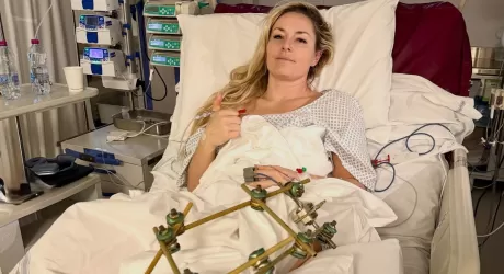 Vonn terzo intervento alla gamba e prima foto dopo l'infortunio